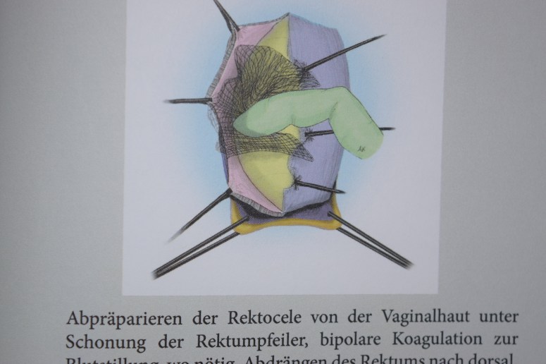 ουρογυναικολόγος από γερμανία
