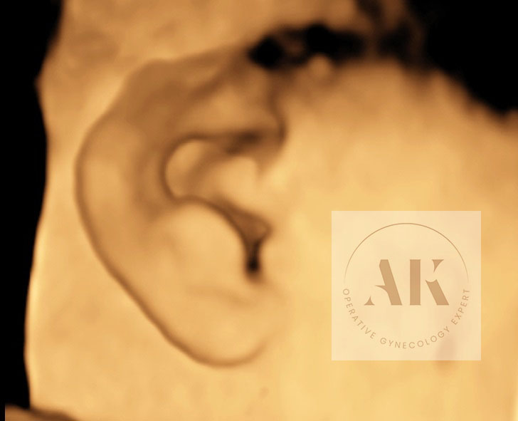 αυτί εμβρύου