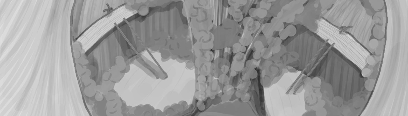 κολποανάρτηση