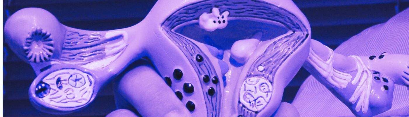 πολύποδες ενδομητρίου εξώφυλλο