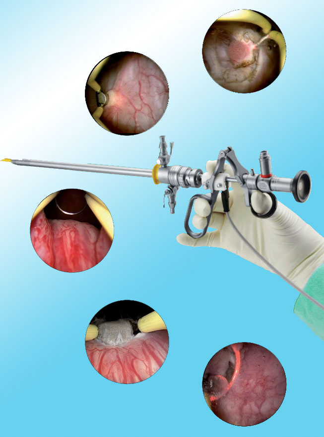 υστεροσκόπηση από εξειδικευμένο γυναικολόγο στη Θεσσαλονίκη