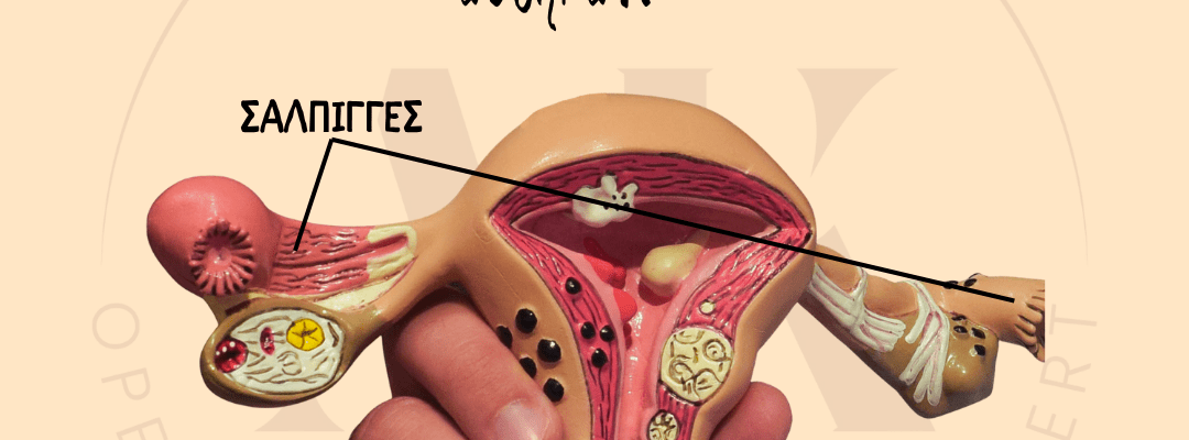 ογκοπροφυλακτική σαλπιγγεκτομή