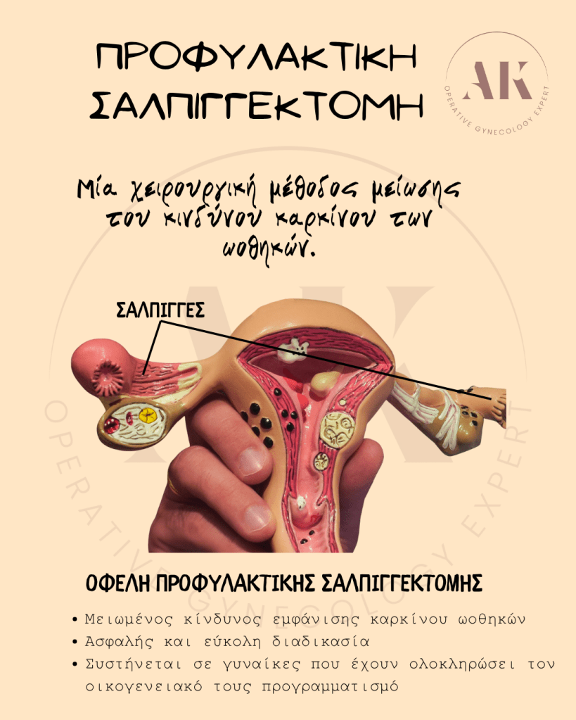 προφυλακτική σαλπιγγεκτομή μείωση κινδύνου καρκίνου ωοθηκών