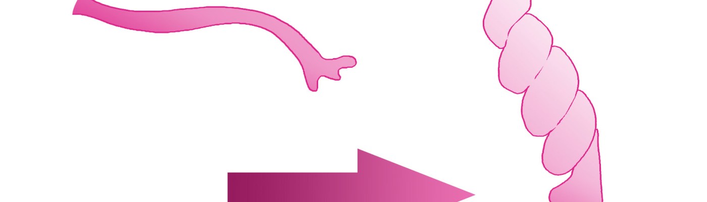 συστροφή σάλπιγγας