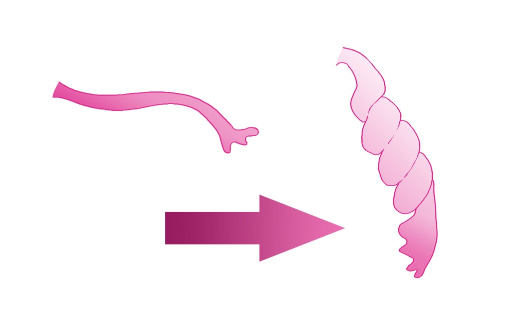 συστροφή σάλπιγγας