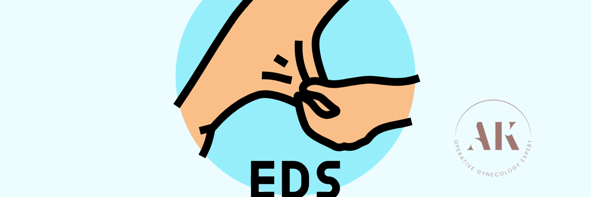 γυναικολόγος για Ehlers-Danlos