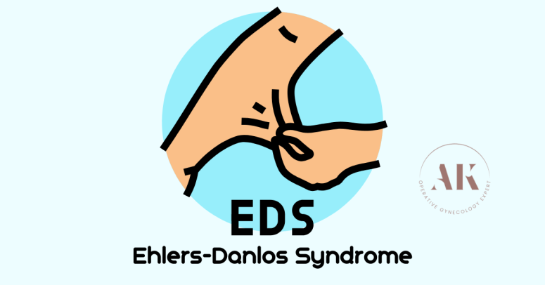 γυναικολόγος για Ehlers-Danlos